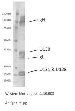 Cytomegalovirus gH Pentamer Complex Antibody, Novus Biologicals 0.5 mg;