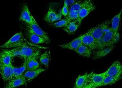 Cytosolic Sulfotransferase 1A1/SULT1A1 Rabbit anti-Human, Clone: 34, Novus