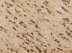 Cytosolic Sulfotransferase 1A1/SULT1A1 Rabbit anti-Human, Clone: 34, Novus
