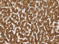 Cytosolic Sulfotransferase 1A1/SULT1A1 Rabbit anti-Human, Clone: 34, Novus