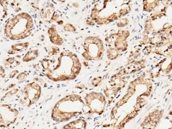 Cytosolic Sulfotransferase 1A1/SULT1A1 Antibody, Novus Biologicals:Antibodies:Primary