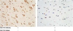 Cytosolic Sulfotransferase 1A1/SULT1A1 Antibody, Novus Biologicals:Antibodies:Primary
