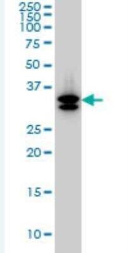 SULT1A3 Antibody (1B10), Novus Biologicals 100 &mu;g | Buy Online | Novus Biologicals | Fisher Scientific