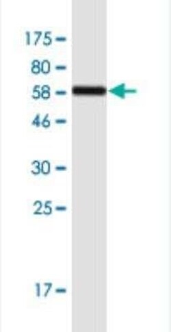 SULT1A3 Antibody (1B10), Novus Biologicals 100 &mu;g | Buy Online | Novus Biologicals | Fisher Scientific