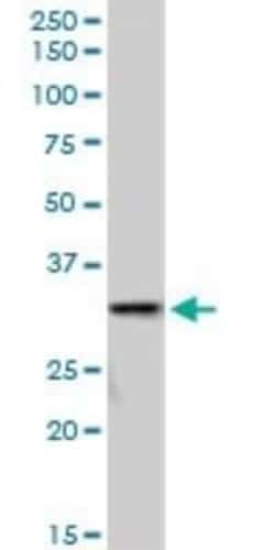 SULT1A3 Antibody, Novus Biologicals 0.05 mg | Buy Online | Novus Biologicals | Fisher Scientific