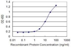 Cytosolic Sulfotransferase 1C2/SULT1C2 Antibody (4D9), Novus Biologicals 0.1 mg | Buy Online | Novus Biologicals | Fisher Scientific