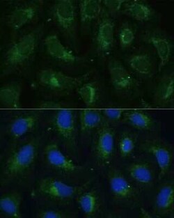Cytosolic Sulfotransferase 1C4/SULT1C4 Antibody - Azide and BSA Free, Novus