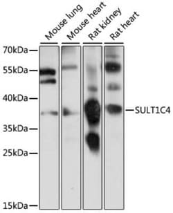 Cytosolic Sulfotransferase 1C4/SULT1C4 Antibody - Azide and BSA Free, Novus