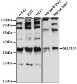 Cytosolic Sulfotransferase 1C4/SULT1C4 Antibody - Azide and BSA Free, Novus