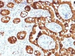 Cytosolic Sulfotransferase 1E1/SULT1E1 Mouse anti-Human, Clone: CPTC-SULT1E1-1,