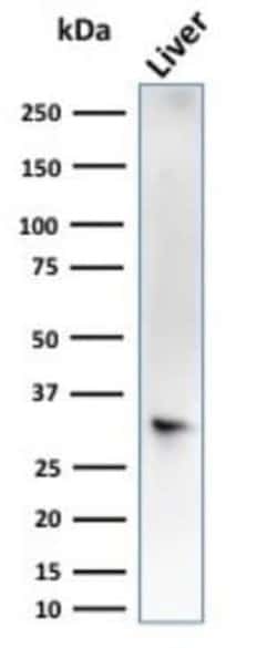 Cytosolic Sulfotransferase 1E1/SULT1E1 Mouse anti-Human, Clone: CPTC-SULT1E1-1,
