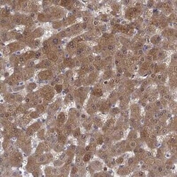 Cytosolic Sulfotransferase 2A1/SULT2A1 Antibody, Novus Biologicals 25 &mu;L,