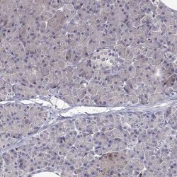 Cytosolic Sulfotransferase 2A1/SULT2A1 Antibody, Novus Biologicals 25 &mu;L,