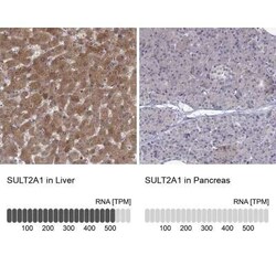 Cytosolic Sulfotransferase 2A1/SULT2A1 Antibody, Novus Biologicals 25 &mu;L,