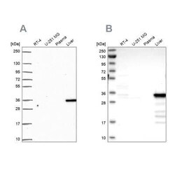 Cytosolic Sulfotransferase 2A1/SULT2A1 Antibody, Novus Biologicals 25 &mu;L,