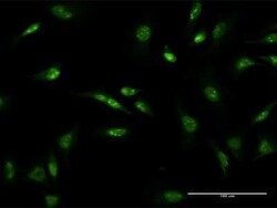 D4S234E Antibody (1D22), Novus Biologicals 0.1 mg | Buy Online | Novus Biologicals | Fisher Scientific