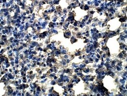 D4S234E Antibody, Novus Biologicals 100 &mu;g | Buy Online | Novus Biologicals | Fisher Scientific