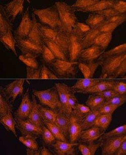 DAAM2 Antibody - BSA Free, Novus Biologicals:Antibodies:Primary Antibodies