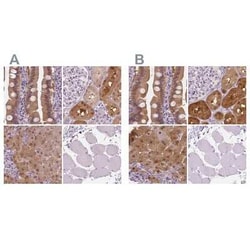 DAK Antibody, Novus Biologicals:Anticorps:Anticorps primaires