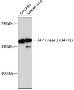 DAP Kinase 1 Rabbit anti-Human, Mouse, Clone: 3E10G3, Novus Biologicals