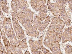 DAP Kinase 2 Antibody, Novus Biologicals:Antibodies:Primary Antibodies