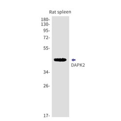 DAP Kinase 2 Antibody (S09-8F2), Novus Biologicals:Antibodies:Primary Antibodies