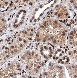 DAP10/HCST Antibody (982107), Unconjugated, Novus Biologicals 25ug; Unconjugated:Antibodies,