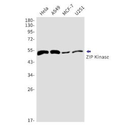 DAPK3/ZIPK Rabbit anti-Human, Clone: S02-7F5, Novus Biologicals:Antibodies:Primary