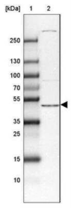 DAPK3/ZIPK Antibody, Novus Biologicals 25 &mu;L; Unconjugated:Anticuerpos