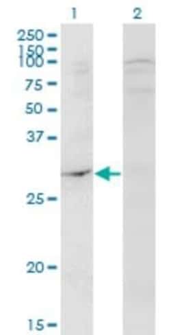 DAPP1 Antibody (1E1), Novus Biologicals 0.1 mg | Buy Online | Novus Biologicals | Fisher Scientific