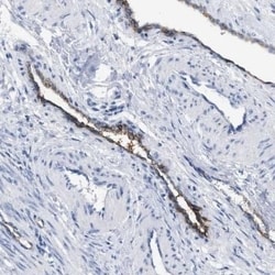 DARC Antibody, Novus Biologicals 25 &mu;L; Unconjugated:Antibodies, Polyclonal