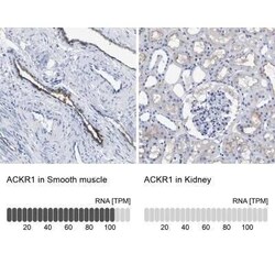 DARC Antibody, Novus Biologicals 25 &mu;L; Unconjugated:Antibodies, Polyclonal