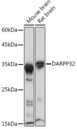 DARPP-32 Rabbit anti-Human, Mouse, Rat, Clone: 5T9G4, Novus Biologicals 20 &mu;g | Buy Online | Novus Biologicals | Fisher Scientific