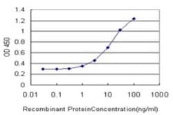 DARS Antibody (2F11), Novus Biologicals 0.1 mg, Unconjugated:Antibodies,