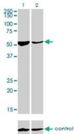 DARS Antibody (2F11), Novus Biologicals 0.1 mg, Unconjugated:Antibodies,