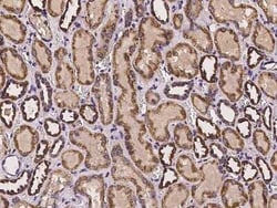 DARS2 Antibody, Novus Biologicals 100 &mu;g | Buy Online | Novus Biologicals | Fisher Scientific