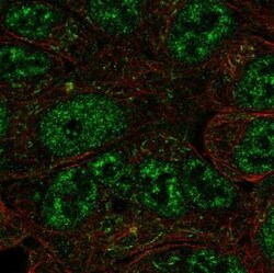 DAX1/NR0B1 Antibody, Novus Biologicals 25 &mu;L | Buy Online | Novus Biologicals | Fisher Scientific