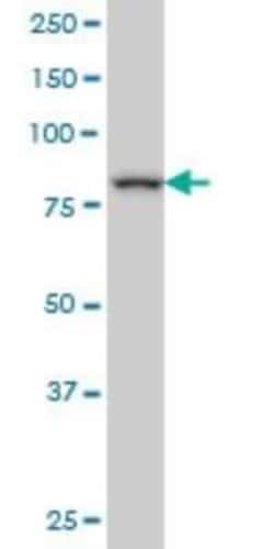 Novus Biologicals DAZ1 Antibody (4F3), Novus Biologicals 0.1 mg; Unconjugated:Antibodies,