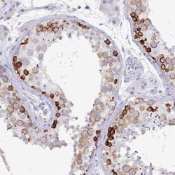 DAZ1 Antibody, Novus Biologicals:Antibodies:Primary Antibodies