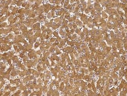 DAZ1 Antibody, Novus Biologicals 100 &mu;g, Unconjugated:Antibodies, Polyclonal