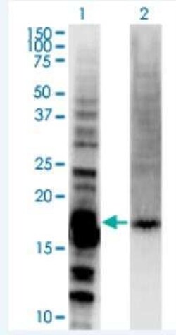 DAZAP2 Antibody (8G5), Novus Biologicals 100 &mu;g | Buy Online | Novus Biologicals | Fisher Scientific