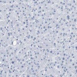 DBC1 Antibody, Novus Biologicals 25 &mu;L; Unconjugated:Antibodies, Polyclonal