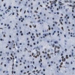 DBC1 Antibody, Novus Biologicals 25 &mu;L; Unconjugated:Antibodies, Polyclonal