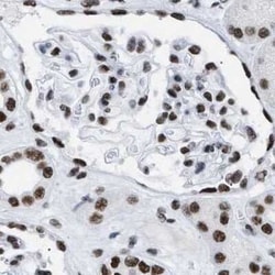 DBC1 Antibody, Novus Biologicals 25 &mu;L; Unconjugated:Antibodies, Polyclonal