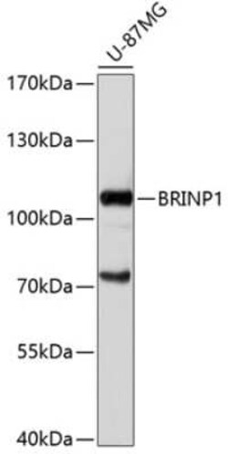 DBC1 Antibody - Azide and BSA Free, Novus Biologicals:Antibodies:Primary