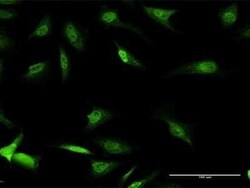 DBPA Antibody, Novus Biologicals 0.05 mg | Buy Online | Novus Biologicals | Fisher Scientific