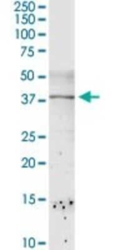 DBPA Antibody, Novus Biologicals 0.1 mg | Buy Online | Novus Biologicals | Fisher Scientific