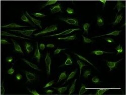 DBR1 Antibody (3A7), Novus Biologicals 0.1 mg | Buy Online | Novus Biologicals | Fisher Scientific