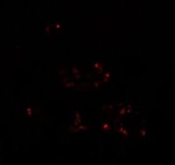 DBX2 Antibody - BSA Free, Novus Biologicals 0.1 mg; Unconjugated:Antibodies,