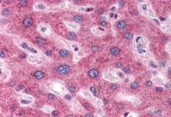 DC2 Antibody, Novus Biologicals 50 &mu;g | Buy Online | Bio-Techne | Fisher Scientific